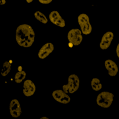 NS Reagents TDP43 Antibody (Cat-AA17-100105) Image 2